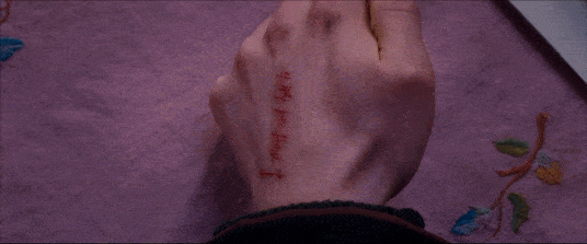 Mão de Harry Potter machucada